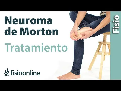 Descubre los mejores ejercicios para el Neuroma de Morton