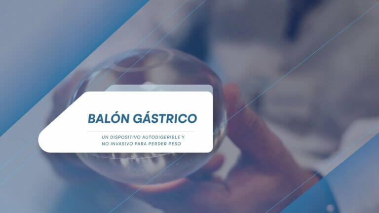 Balón gástrico: Beneficios y cobertura en la seguridad social