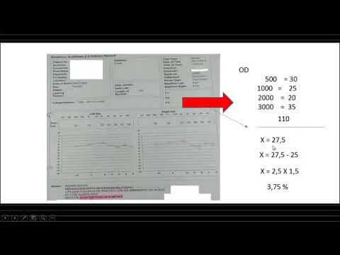 Guía de Tablas de Grado de Minusvalía Auditiva