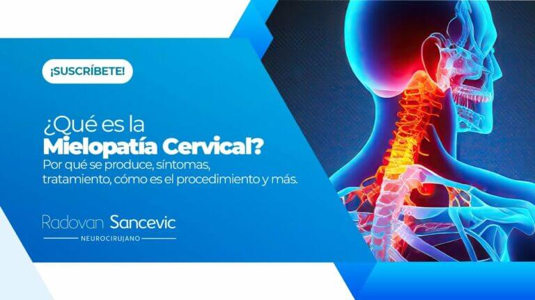 Incapacidad permanente por mielopatía cervical: Todo lo que debes saber